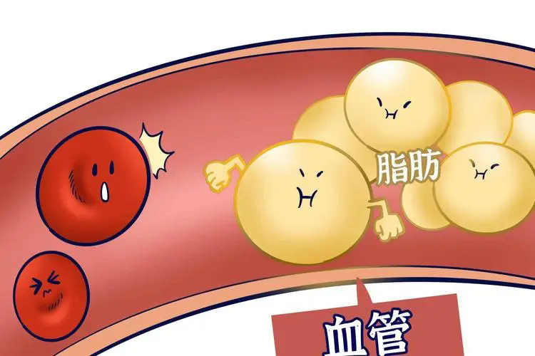 特别提醒：你的血管是否该减脂了！